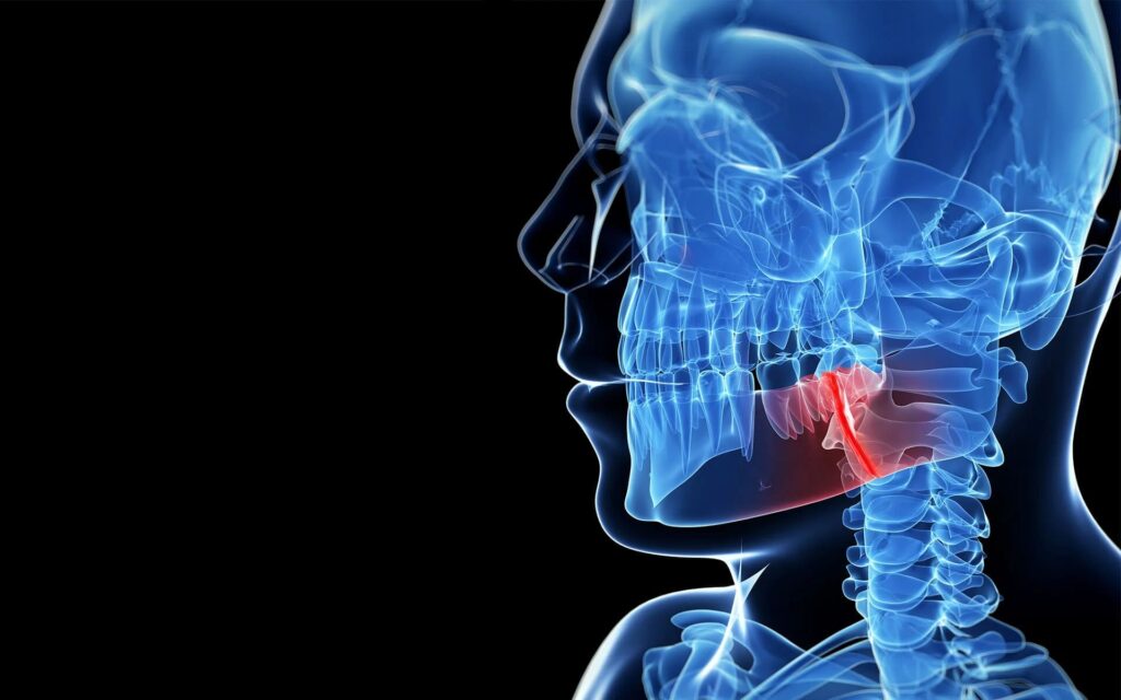 Managing Jaw Popping: Causes, Symptoms, and Treatment Options - Catchy ...